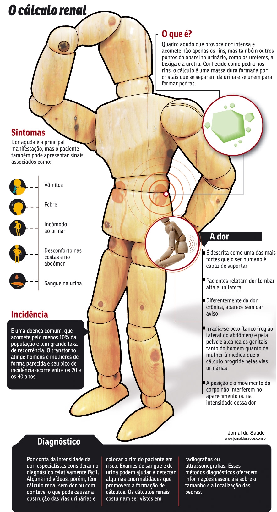 Pedra nos Rins - Clculo Renal